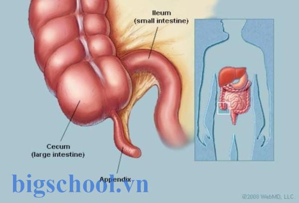 Viêm ruột thừa cấp: Cẩm nang những điều cần biết về bệnh | Vinmec